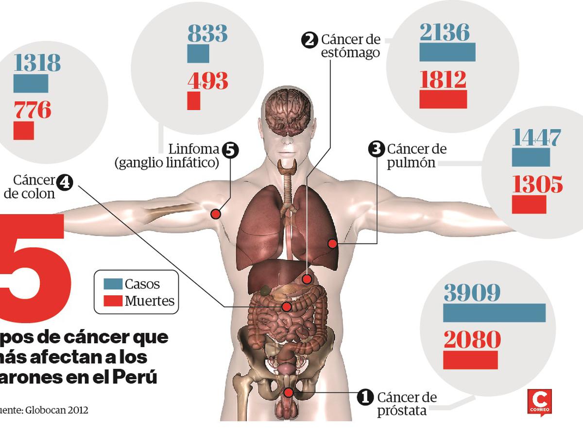 El Heraldo de Poza Rica Alertan sobre alza de cáncer en hombre