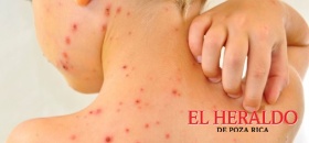 Activan vigilancia epidemiológica